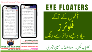 فلوٹرز آنکھوں کے آگے داغ دھبے فلوٹرز دائرے اور نظر کے مسائل ۔ ڈپریشن انگزائٹی مایوسی ۔۔ کامیاب کیس علاج دوا ۔۔ حسین قیصرانی
