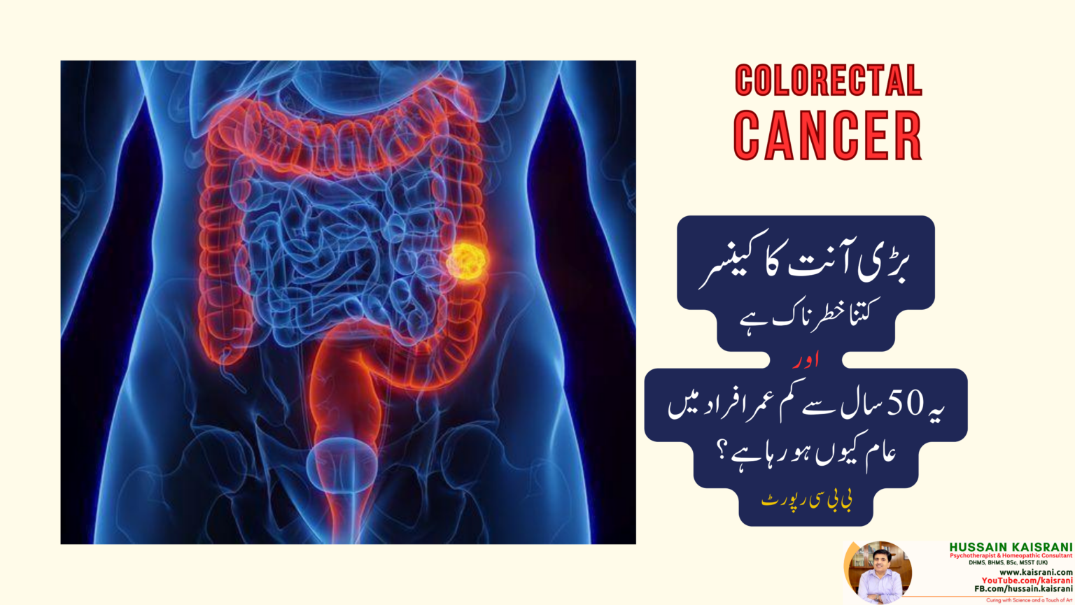 <span class="urdu-title" dir="rtl">بڑی آنت کا کینسر کتنا خطرناک ہے اور یہ 50 سال سے کم عمر افراد میں عام کیوں ہو رہا ہے؟</span>