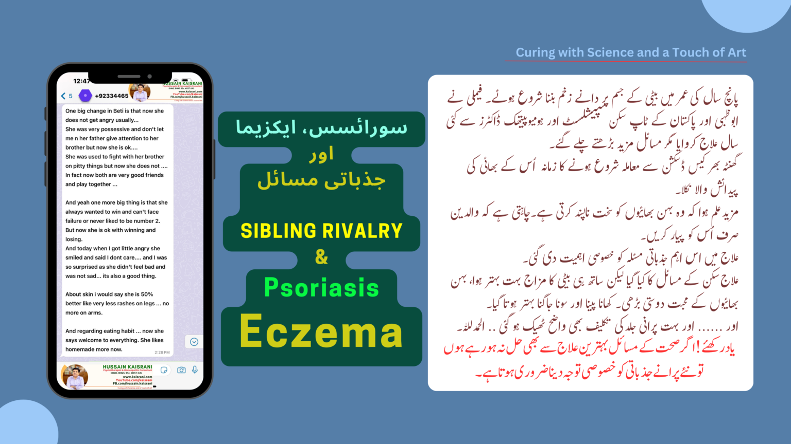 <span class="urdu-title" dir="rtl">چنبل، سوریاسس، ایکزیما، سکن کی بیماریاں اور جذباتی مسائل .. ایک نقطہ نظر … حسین قیصرانی</span>